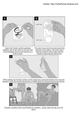 Thumbnail How To Use a Female Condoms Thumbnail How To Use a Female Condoms